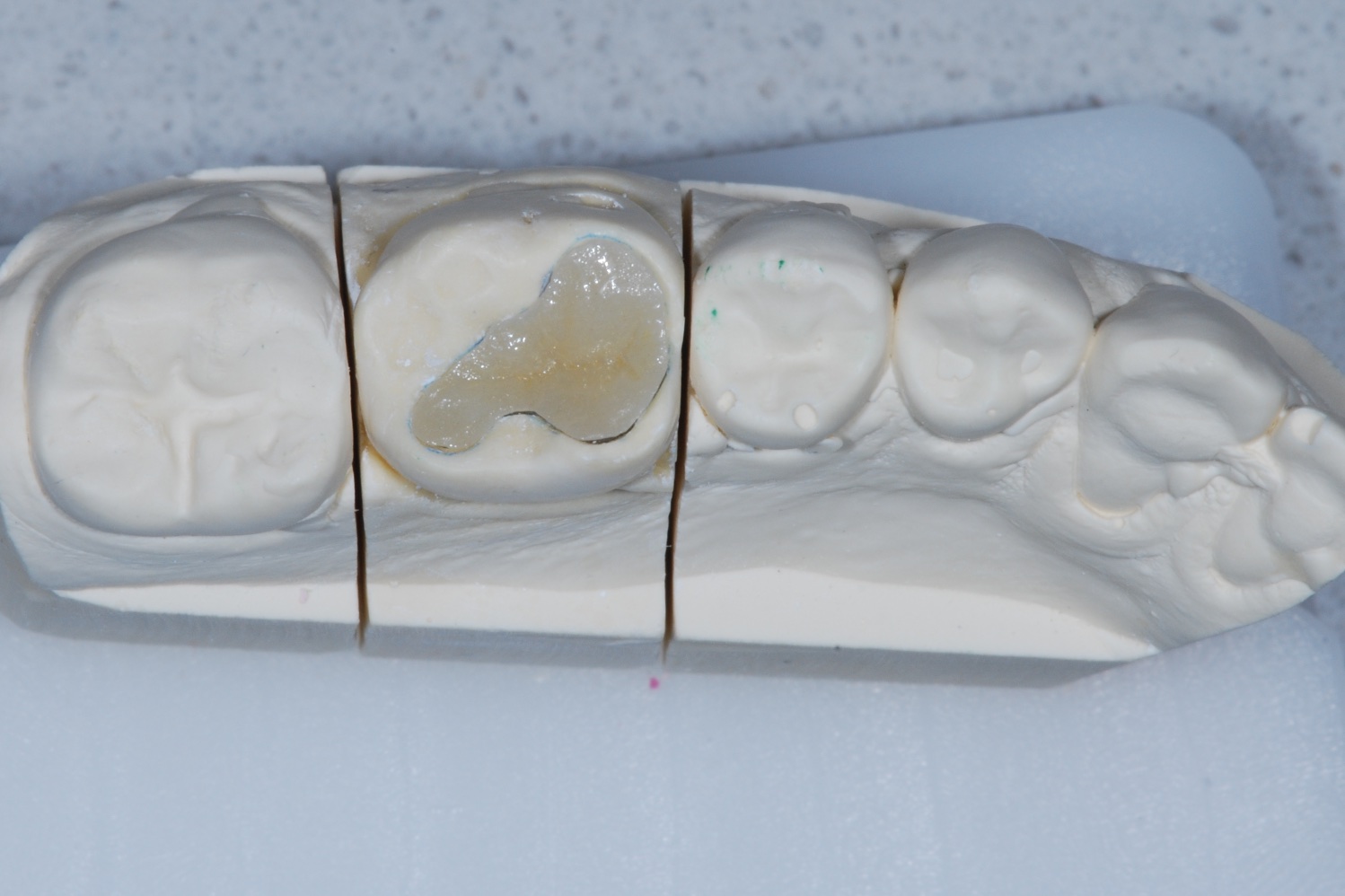 Dr. Rotella - Dental Restorations