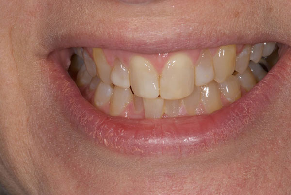 Complex cases in Toronto by Dr. Mario Rotella